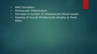 • MAC formation
• Perivascular inflammation
• Decrease in number of intramuscular blood vessels
• Hypoxia of muscle-Perifascicular atrophy as these
fibers.
 