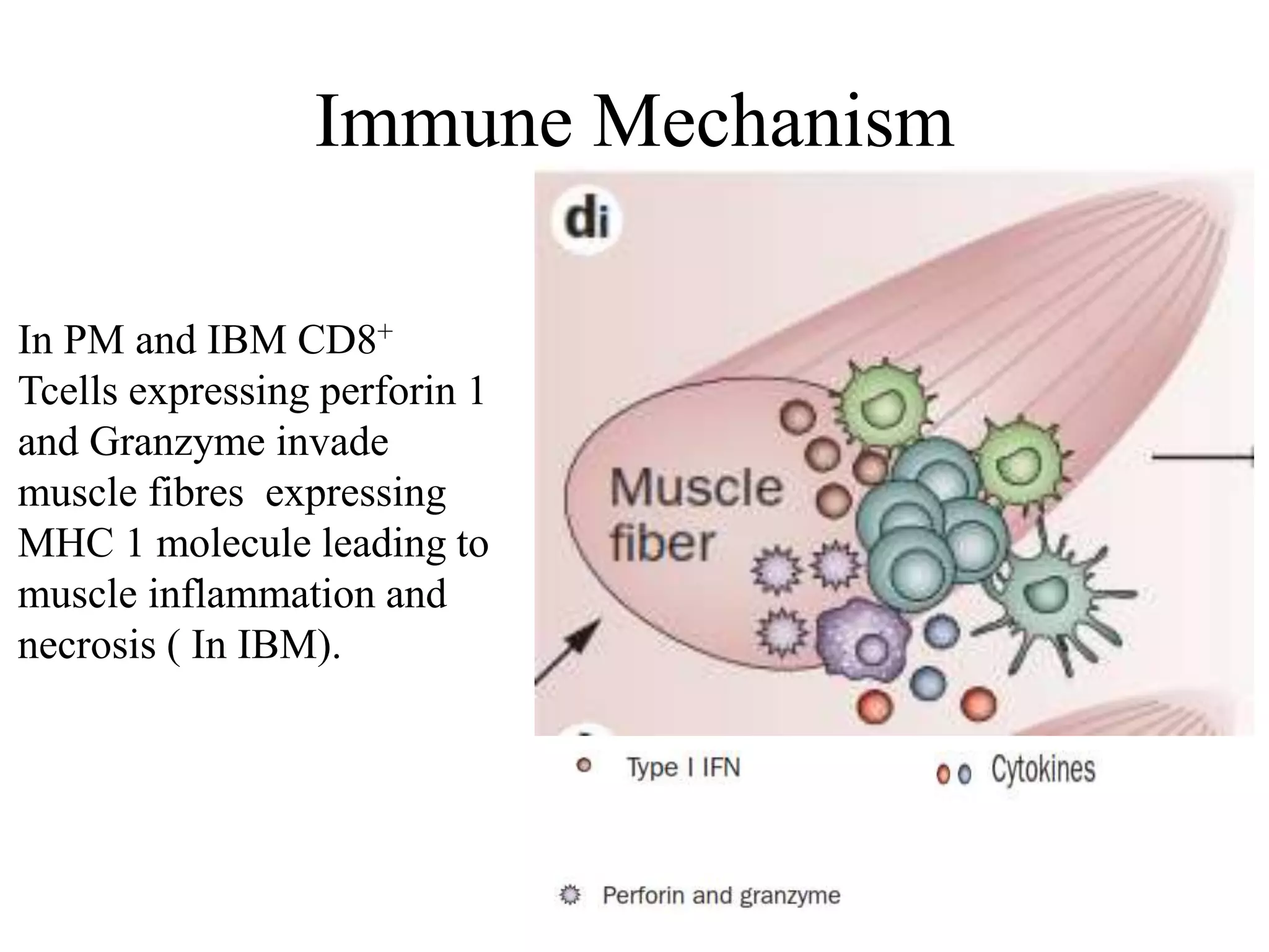 Immune Mechanism
In PM and IBM CD8+
Tcells expressing perforin 1
and Granzyme invade
muscle fibres expressing
MHC 1 molecule leading to
muscle inflammation and
necrosis ( In IBM).
 