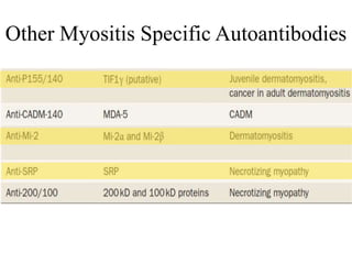 Other Myositis Specific Autoantibodies
 
