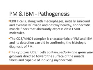 PM & IBM - Pathogenesis
CD8 T cells, along with macrophages, initially surround
and eventually invade and destroy healthy, nonnecrotic
muscle fibers that aberrantly express class I MHC
molecules.
The CD8/MHC-I complex is characteristic of PM and IBM
and its detection can aid in confirming the histologic
diagnosis of PM.
The cytotoxic CD8 T cells contain perforin and granzyme
granules directed toward the surface of the muscle
fibers and capable of inducing myonecrosis.
 