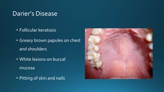 Inflammatory Overgrowths PPTX Inflammatory Overgrowths PPTX