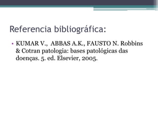Referencia bibliográfica:
• KUMAR V., ABBAS A.K., FAUSTO N. Robbins
& Cotran patologia: bases patológicas das
doenças. 5. ed. Elsevier, 2005.
 