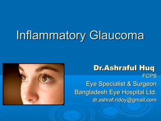 Inflammatory GlaucomaInflammatory Glaucoma
Dr.Ashraful HuqDr.Ashraful Huq
FCPSFCPS
Eye Specialist & SurgeonEye Specialist & Surgeon
Bangladesh Eye Hospital Ltd.Bangladesh Eye Hospital Ltd.
dr.ashraf.ridoy@gmail.comdr.ashraf.ridoy@gmail.com
 