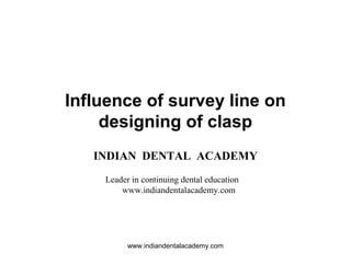 Influence of survey line on
designing of clasp
INDIAN DENTAL ACADEMY
Leader in continuing dental education
www.indiandentalacademy.com
www.indiandentalacademy.com
 