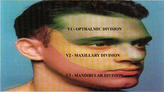 V3 - MANDIBULAR DIVISION
V1 - OPTHALMIC DIVISION
V2 - MAXILLARY DIVISION
 
