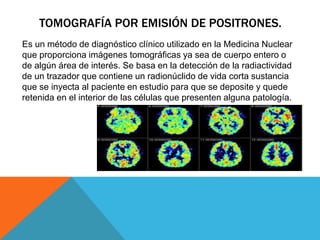 TOMOGRAFÍA POR EMISIÓN DE POSITRONES.
Es un método de diagnóstico clínico utilizado en la Medicina Nuclear
que proporciona imágenes tomográficas ya sea de cuerpo entero o
de algún área de interés. Se basa en la detección de la radiactividad
de un trazador que contiene un radionúclido de vida corta sustancia
que se inyecta al paciente en estudio para que se deposite y quede
retenida en el interior de las células que presenten alguna patología.
 