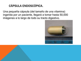CÁPSULA ENDOSCÓPICA.
Una pequeña cápsula (del tamaño de una vitamina)
ingerida por un paciente, llegará a tomar hasta 50,000
imágenes a lo largo de todo su tracto digestivo.
 