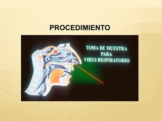 Enfermedades crónicas: Pulmonares, Cardiovasculares, Diabetes, disfunción renal.INFLUENZA  TIPOAH1N1FLUJOGRAMA PARA LA IDENTIFICACION Y MANEJO DE CASOS SOSPECHOSOS