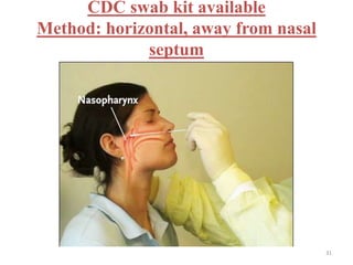 CDC swab kit available 
Method: horizontal, away from nasal 
septum 
31 
 