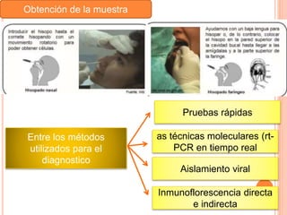 Obtención de la muestra
Entre los métodos
utilizados para el
diagnostico
Pruebas rápidas
as técnicas moleculares (rt-
PCR en tiempo real
Aislamiento viral
Inmunoflorescencia directa
e indirecta
 