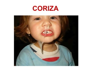 CORIZA 
