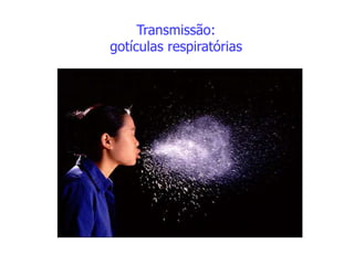 Transmissão:
gotículas respiratórias
 