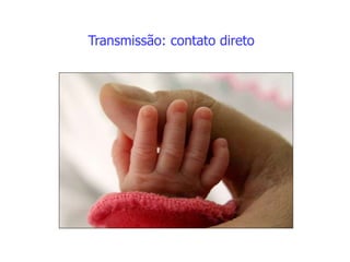 Transmissão: contato direto
 