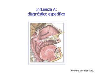 Influenza A:
diagnóstico específico
Ministério da Saúde, 2009.
 