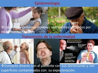 Epidemiologia
Transmisión de la enfermedad
Los niños y personas mayores son los mas afectados por
esta enfermedad
Contacto directo con el paciente con sus secreciones y con
superficies contaminadas con su expectoración.
 