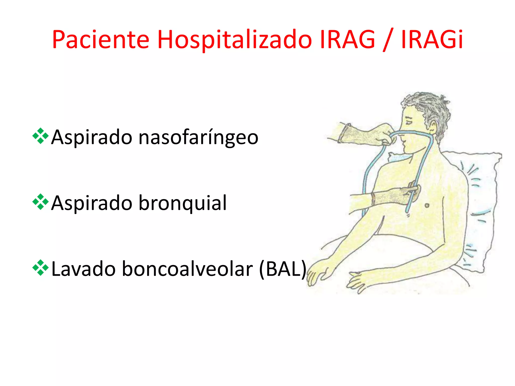 Aspirado nasofaríngeo
Aspirado bronquial
Lavado boncoalveolar (BAL)
Paciente Hospitalizado IRAG / IRAGi
 