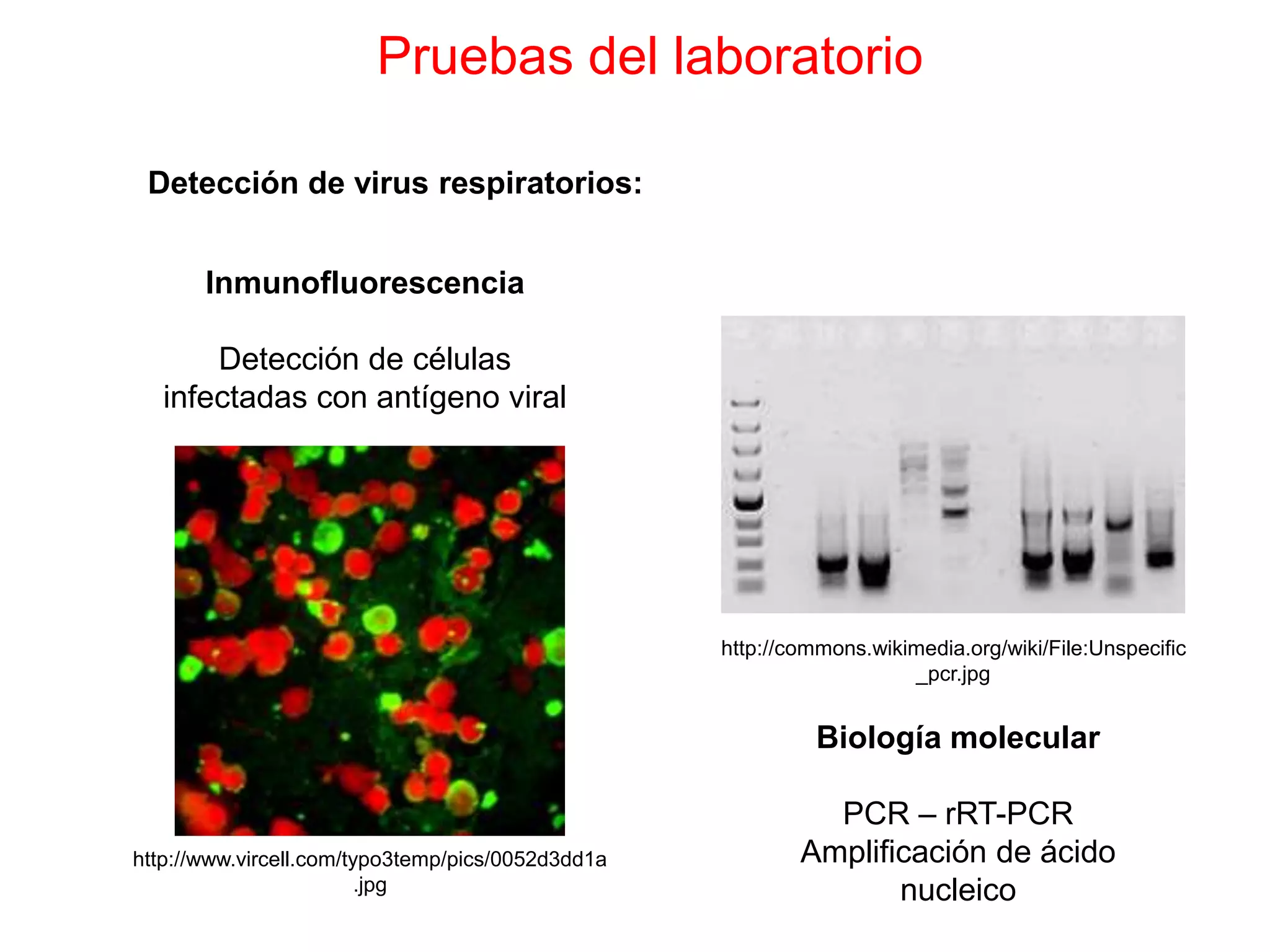 Pruebas del laboratorio
Detección de virus respiratorios:
Inmunofluorescencia
Detección de células
infectadas con antígeno viral
Biología molecular
PCR – rRT-PCR
Amplificación de ácido
nucleico
http://www.vircell.com/typo3temp/pics/0052d3dd1a
.jpg
http://commons.wikimedia.org/wiki/File:Unspecific
_pcr.jpg
 