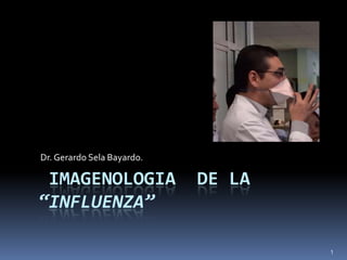 Dr. Gerardo Sela Bayardo.

IMAGENOLOGIA
“INFLUENZA”

DE LA

1

 