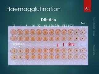 Haemagglutination 64 
Dilution 
2 4 8 16 32 64 128 256 512 
1024 
prozone titre 
No 
virus 
 