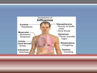 INFLUENZA VIRUSES .pptx