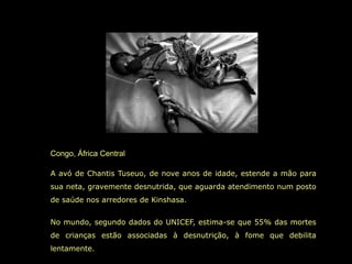 Congo, África Central

A avó de Chantis Tuseuo, de nove anos de idade, estende a mão para
sua neta, gravemente desnutrida, que aguarda atendimento num posto
de saúde nos arredores de Kinshasa.


No mundo, segundo dados do UNICEF, estima-se que 55% das mortes
de crianças estão associadas à desnutrição, à fome que debilita
lentamente.
 