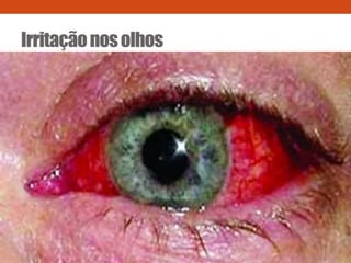 Irritaçãonosolhos
 