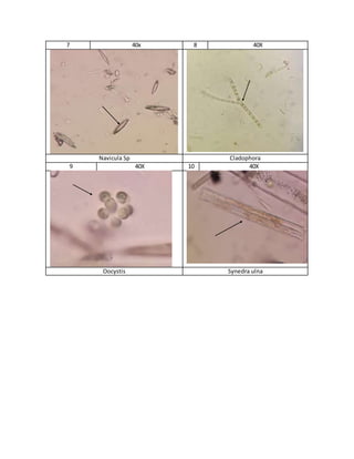 7 40x 8 40X
Navicula Sp Cladophora
9 40X 10 40X
Oocystis Synedra ulna
