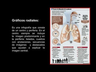 Gráficos radiales:

Es una infografía que consta
de un centro y periferia. En el
centro siempre se incluye
la imagen predominante y en
la periferia: listados, cuadros
con anotaciones, secuencias
de imágenes y destacados
que ayudan a explicar la
imagen central.
 
