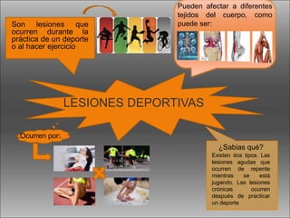 Infografia Lesiones Deportivas PPTX infografia-lesiones-deportivas-pptx