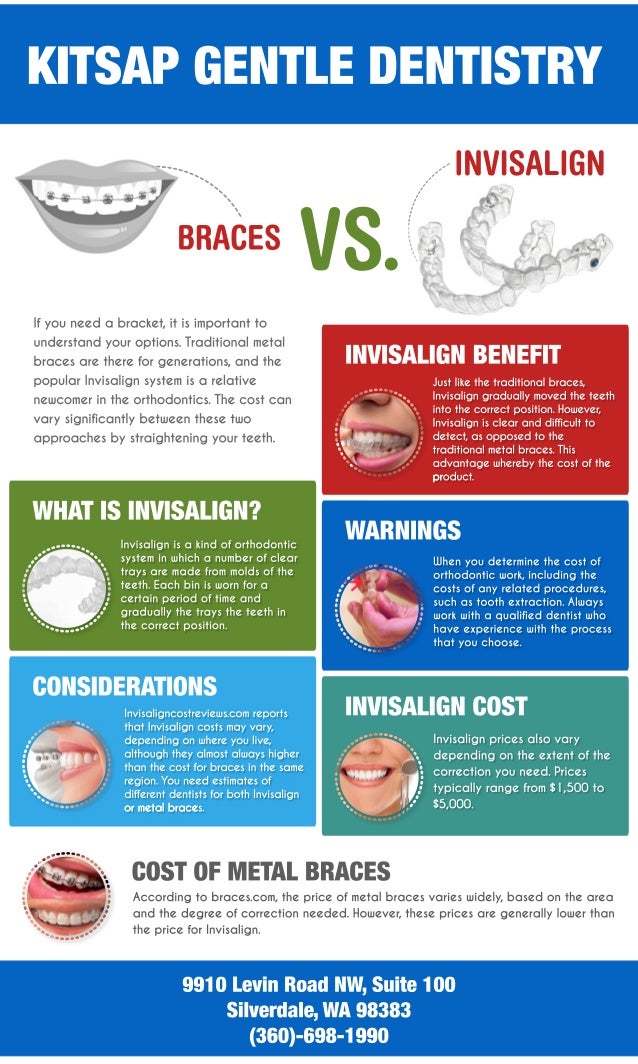 Braces Vs. Invisalign Cost