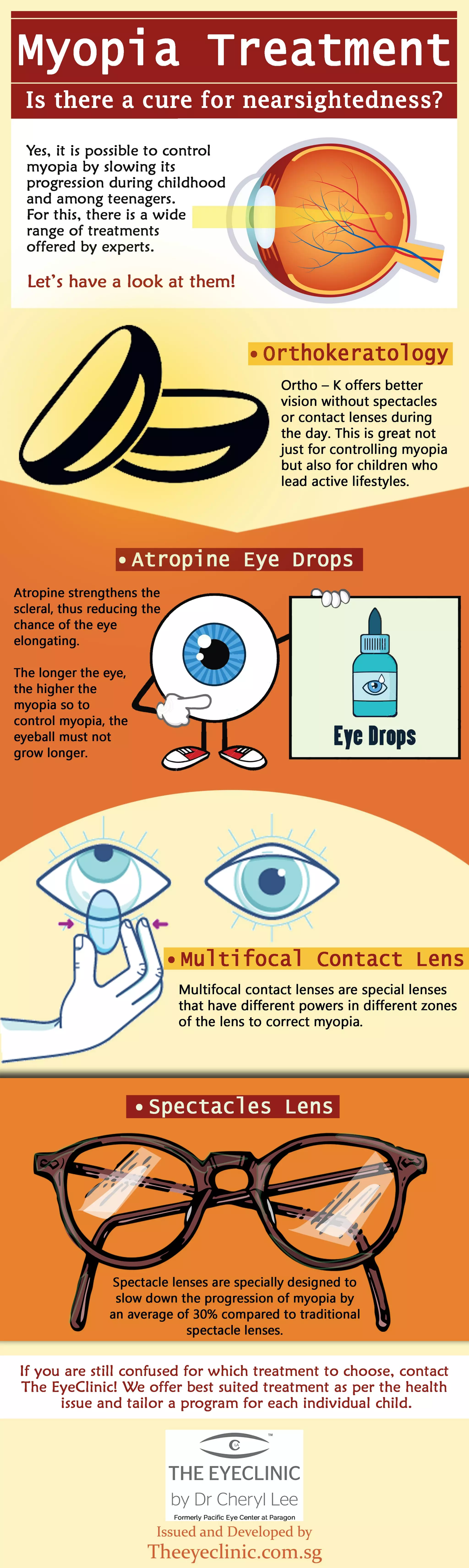 Myopia Treatment Is there a cure for nearsightedness? PDF