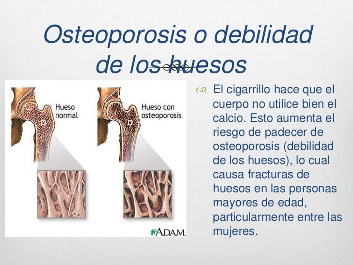 Como afecta el tabaco al cuerpo humano Como afecta el tabaco al cuerpo humano