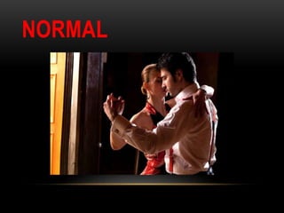 NORMAL