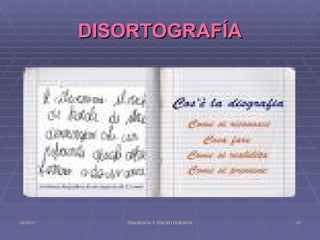DISORTOGRAFÍA 