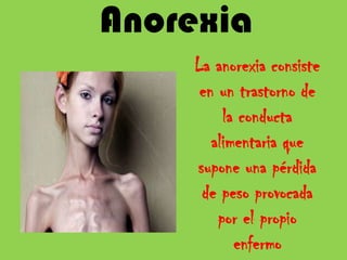 Anorexia
    La anorexia consiste
     en un trastorno de
         la conducta
       alimentaria que
    supone una pérdida
     de peso provocada
        por el propio
           enfermo
 