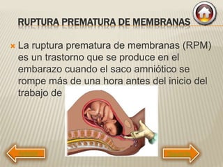RUPTURA PREMATURA DE MEMBRANAS
 La ruptura prematura de membranas (RPM)
es un trastorno que se produce en el
embarazo cuando el saco amniótico se
rompe más de una hora antes del inicio del
trabajo de parto.
Siguiente
 