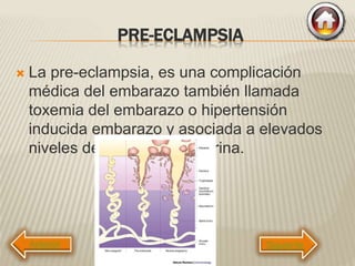 PRE-ECLAMPSIA
 La pre-eclampsia, es una complicación
médica del embarazo también llamada
toxemia del embarazo o hipertensión
inducida embarazo y asociada a elevados
niveles de proteína en la orina.
Siguiente
 