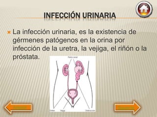 INFECCIÓN URINARIA
 La infección urinaria, es la existencia de
gérmenes patógenos en la orina por
infección de la uretra, la vejiga, el riñón o la
próstata.
Siguiente
 