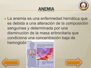 ANEMIA
 La anemia es una enfermedad hemática que
es debida a una alteración de la composición
sanguínea y determinada por una
disminución de la masa eritrocitaria que
condiciona una concentración baja de
hemoglobina.
Siguiente
 