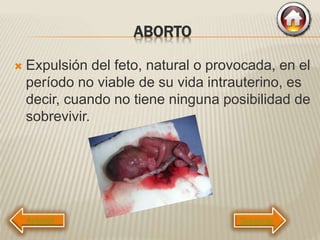 ABORTO
 Expulsión del feto, natural o provocada, en el
período no viable de su vida intrauterino, es
decir, cuando no tiene ninguna posibilidad de
sobrevivir.
Siguiente
 