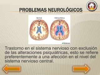 PROBLEMAS NEUROLÓGICOS
Trastorno en el sistema nervioso con exclusión
de las alteraciones psiquiátricas, esto se refiere
preferentemente a una afección en el nivel del
sistema nervioso central.
Siguiente
 