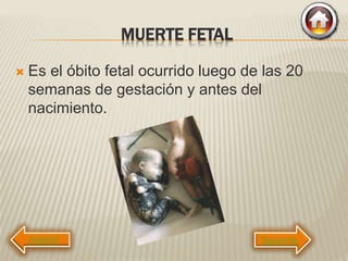 MUERTE FETAL
 Es el óbito fetal ocurrido luego de las 20
semanas de gestación y antes del
nacimiento.
Siguiente
 
