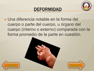 DEFORMIDAD
 Una diferencia notable en la forma del
cuerpo o parte del cuerpo, u órgano del
cuerpo (interno o externo) comparada con la
forma promedio de la parte en cuestión.
Siguiente
 