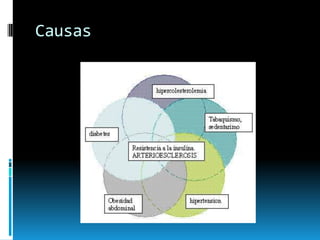 Causas

 
