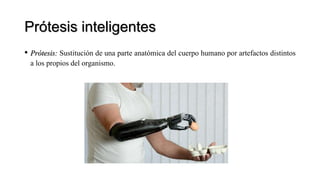Prótesis inteligentes
• Prótesis: Sustitución de una parte anatómica del cuerpo humano por artefactos distintos
a los propios del organismo.
 