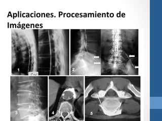Aplicaciones.	
  Procesamiento	
  de	
  
Imágenes	
  
	
  
	
  

	
  
	
  	
  	
  
	
  
	
  

	
  
	
  

	
  
	
  

 