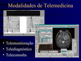Modalidades de Telemedicina




• Telemonitoração
• Telediagnóstico
• Teleconsulta
 