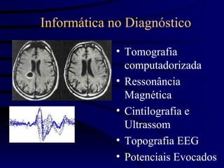 Informática no Diagnóstico

             • Tomografia
               computadorizada
             • Ressonância
               Magnética
             • Cintilografia e
               Ultrassom
             • Topografia EEG
             • Potenciais Evocados
 