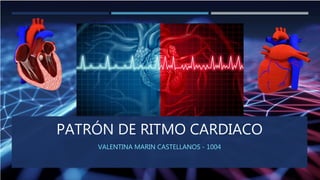 PATRÓN DE RITMO CARDIACO
VALENTINA MARIN CASTELLANOS - 1004
 
