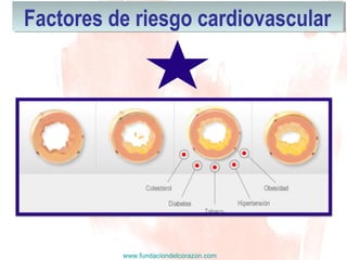 www.fundaciondelcorazon.com
Factores de riesgo cardiovascularFactores de riesgo cardiovascular
 